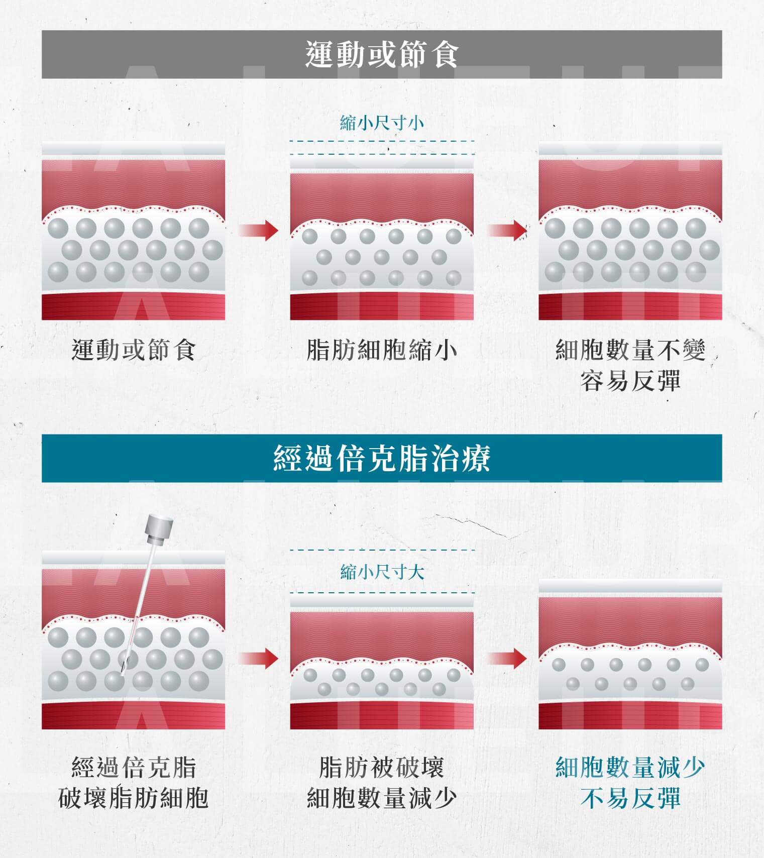 Belkyra倍克脂