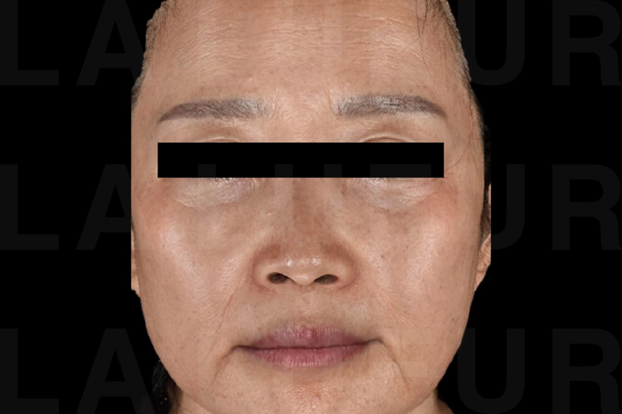 After Image
