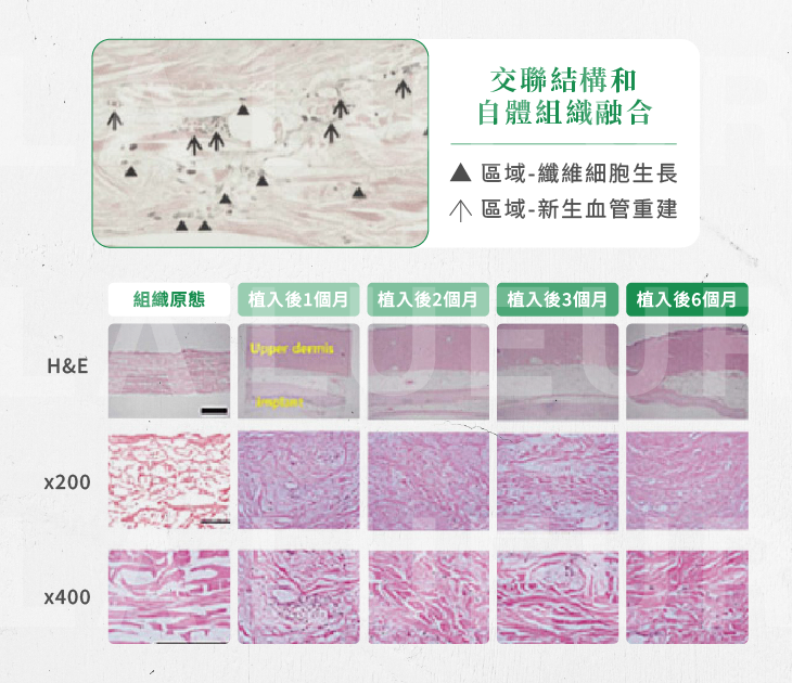 MegaFill異體真皮粉