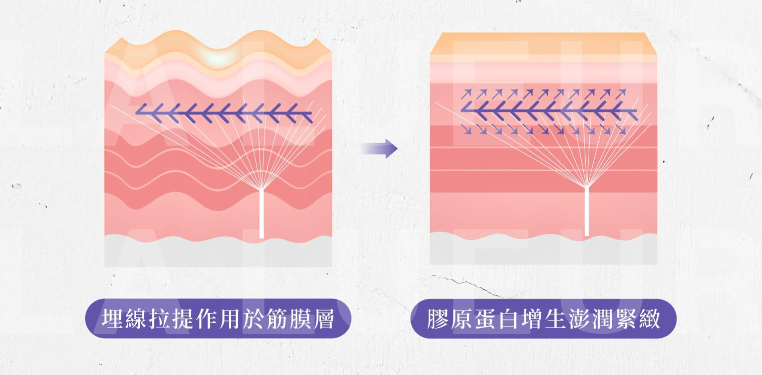 STRATAFLX藍鑽魚骨線