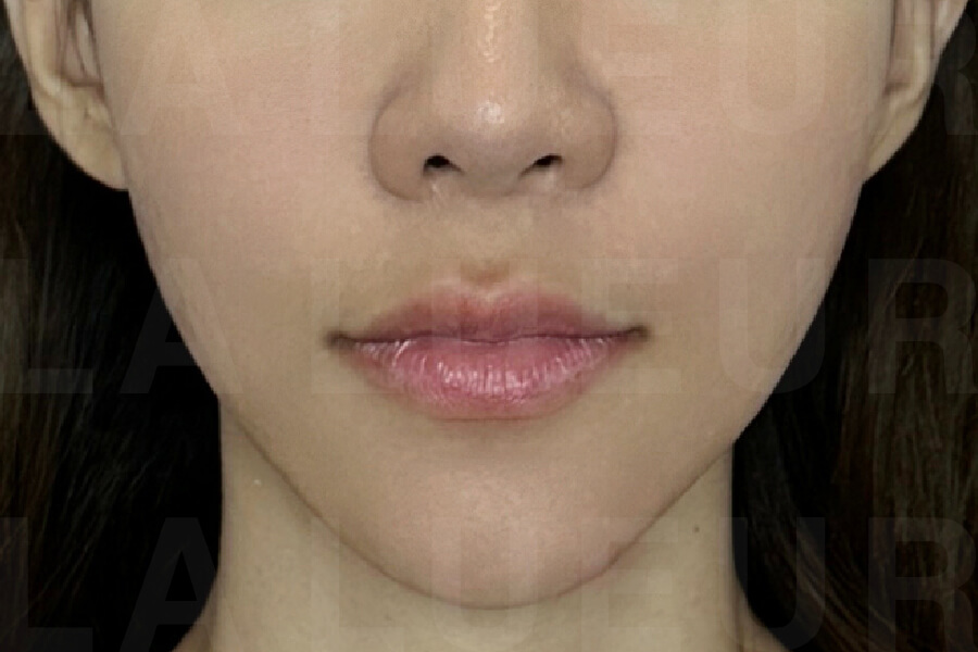 After Image