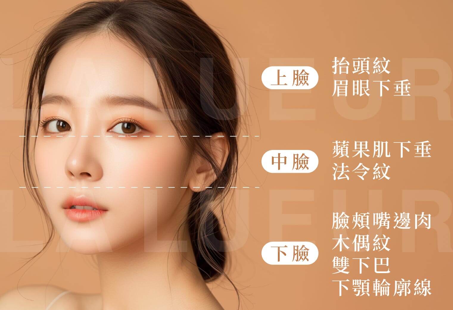埋線拉提