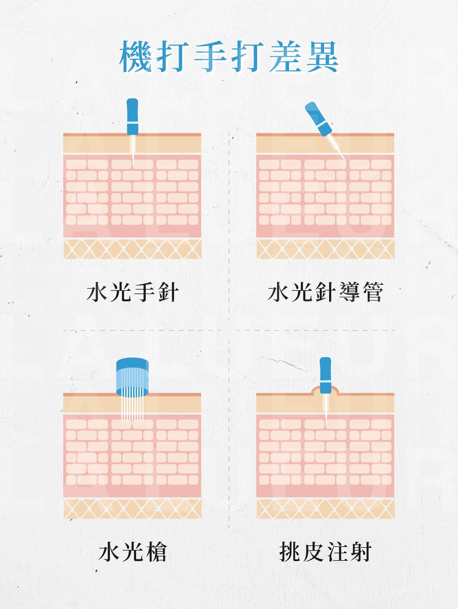 水光針