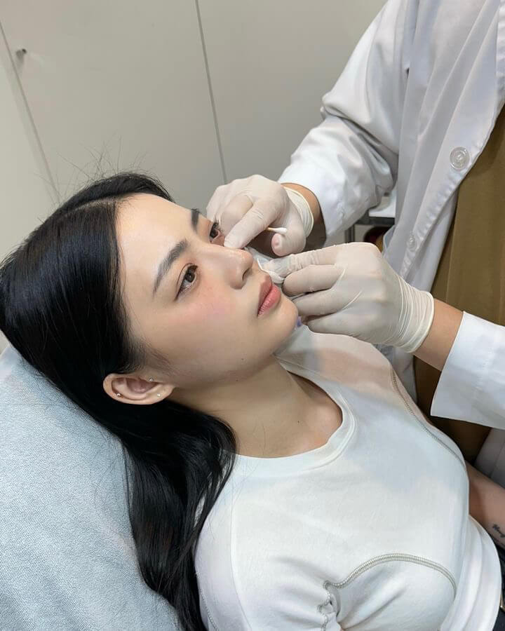 原綺診所熊貓針