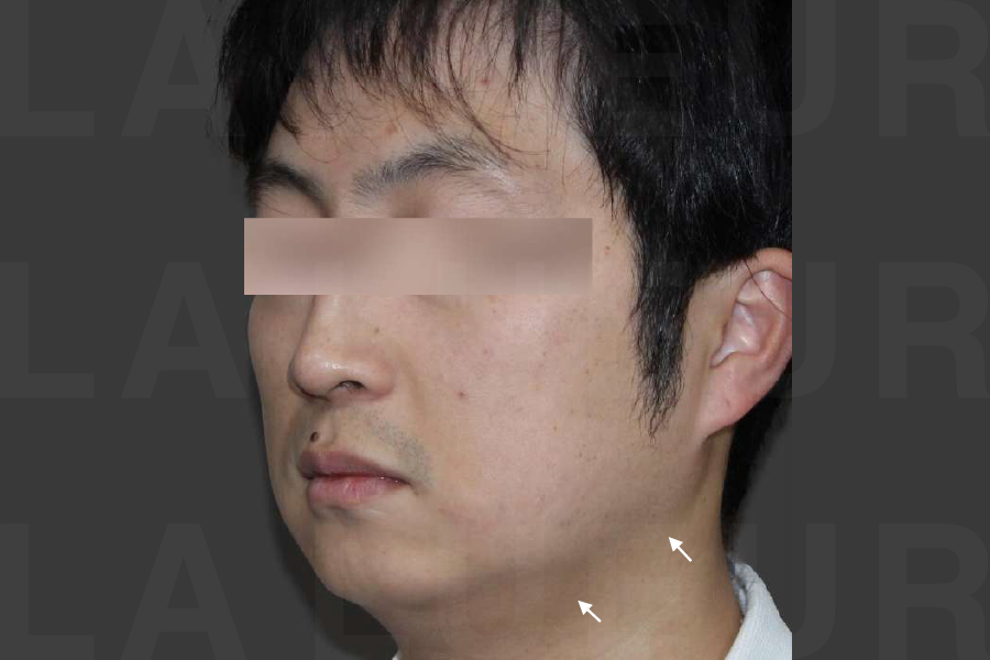 After Image
