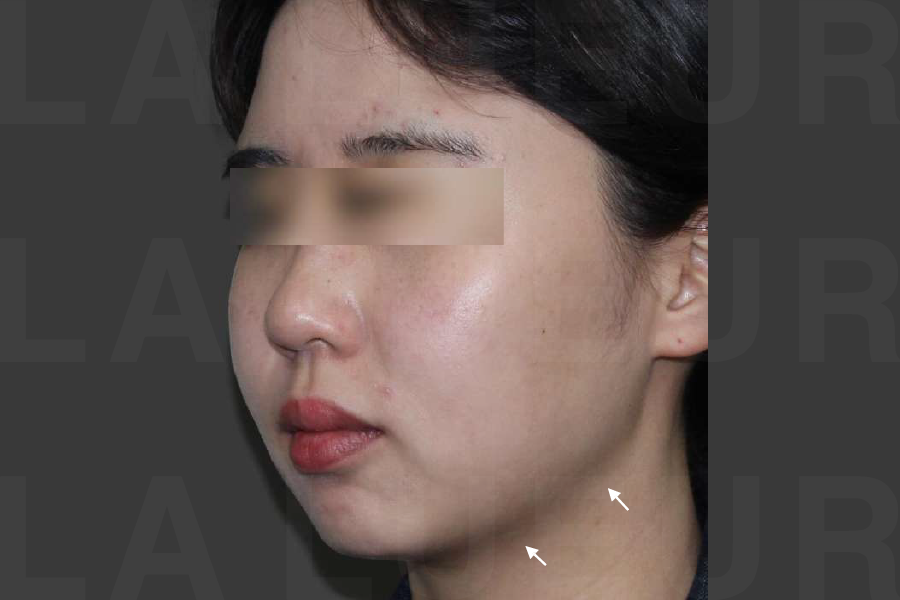 After Image