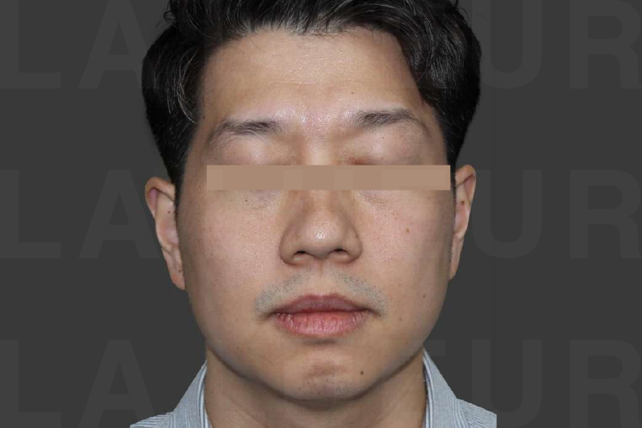 After Image