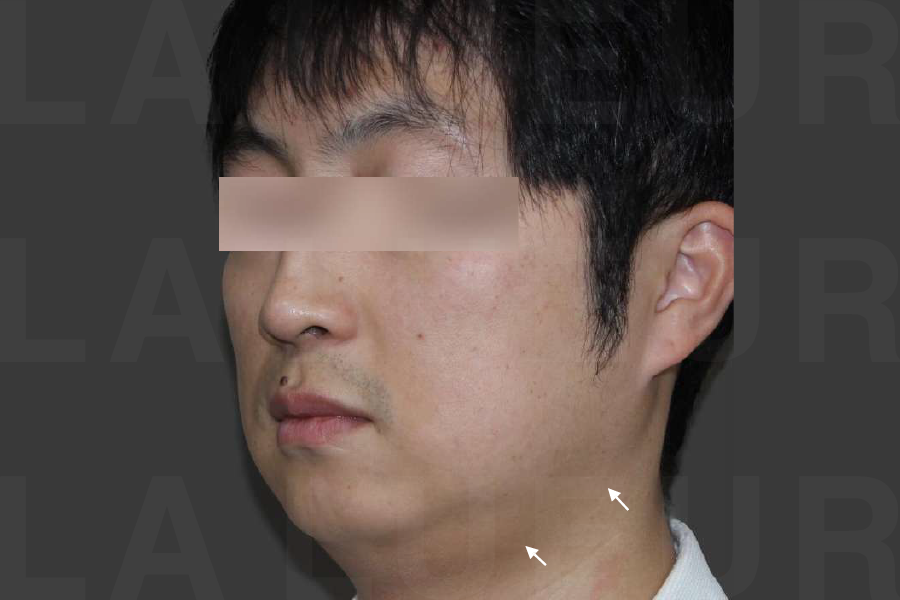 Before Image