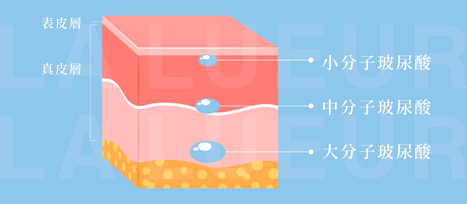 玻尿酸