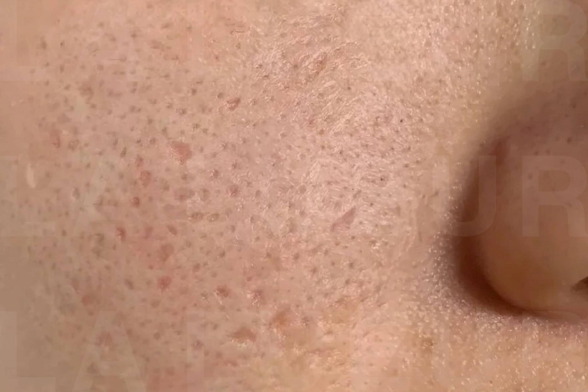 Before Image