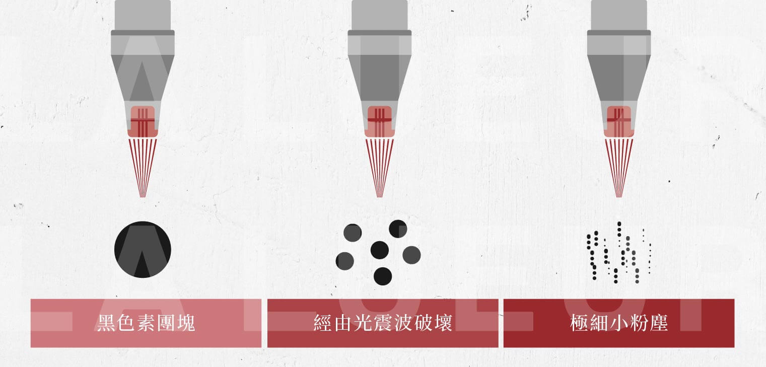 皮秒雷射
