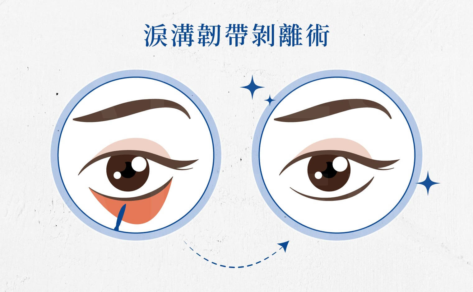 精選療程-極效亮眼褪黑術