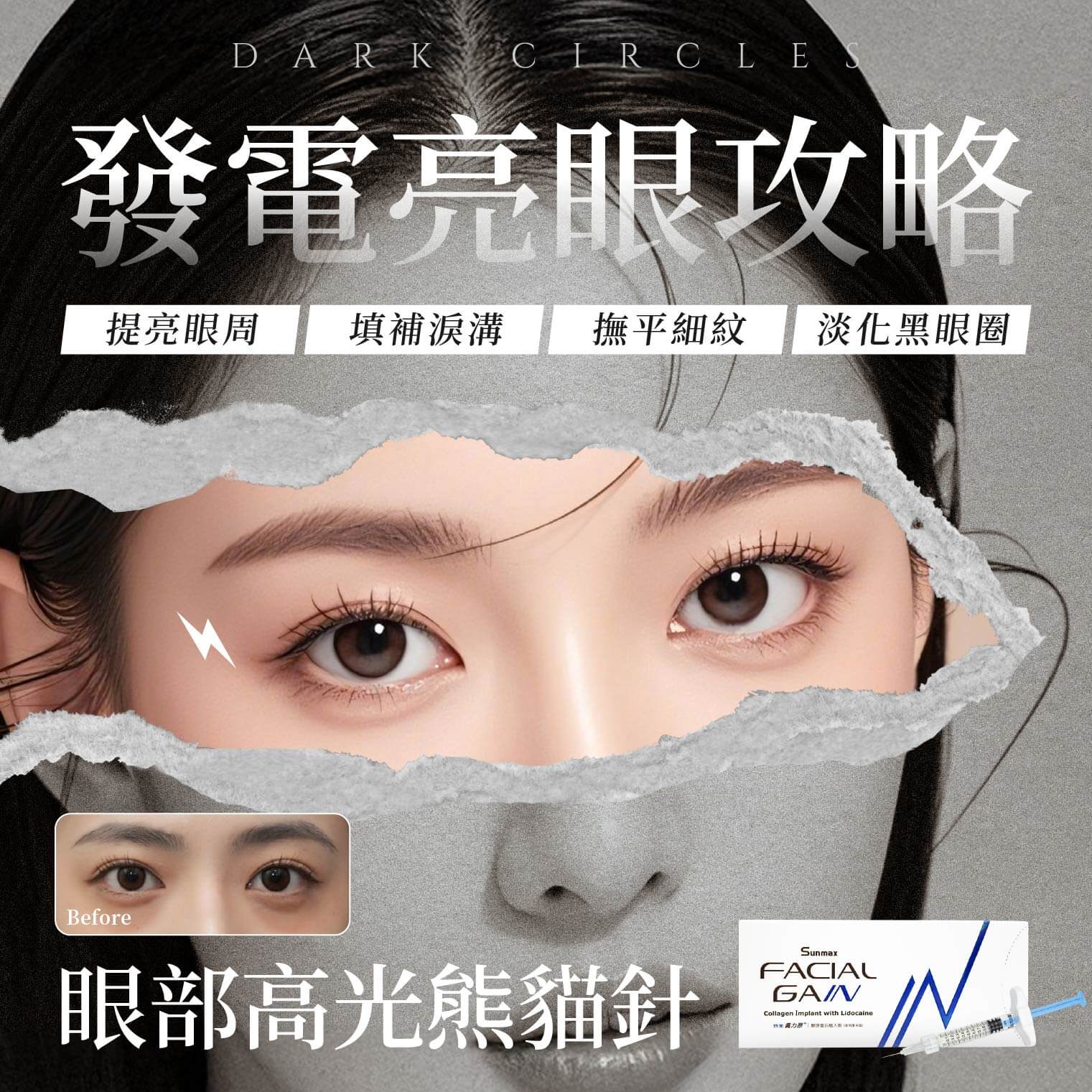 精選療程-蓋不掉的疲憊感