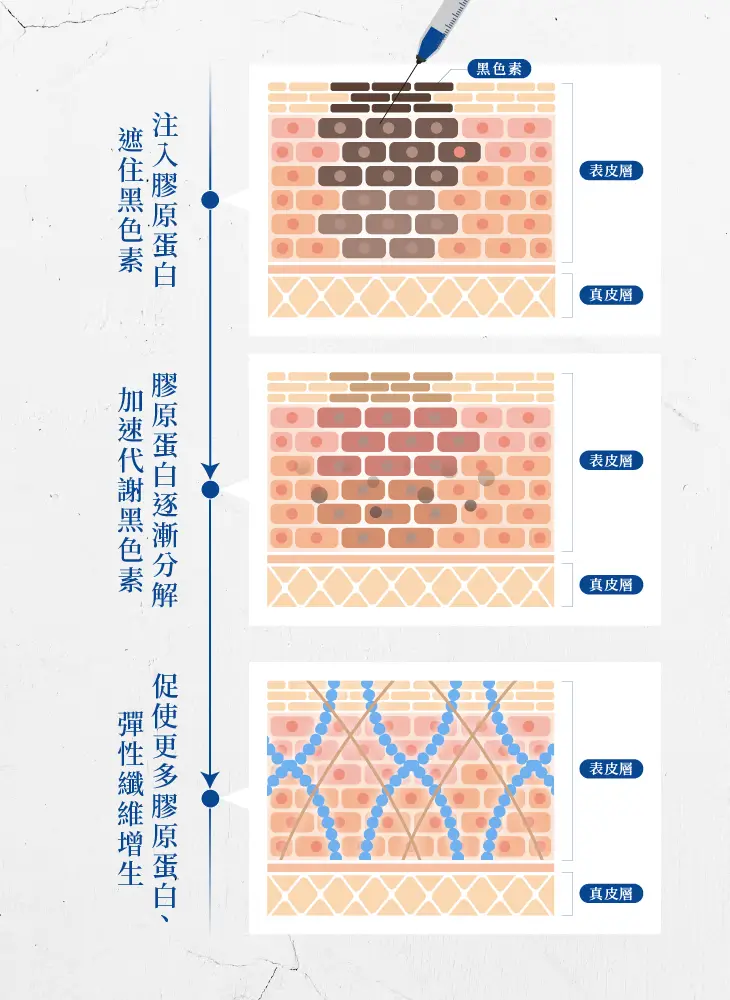 精選療程-蓋不掉的疲憊感
