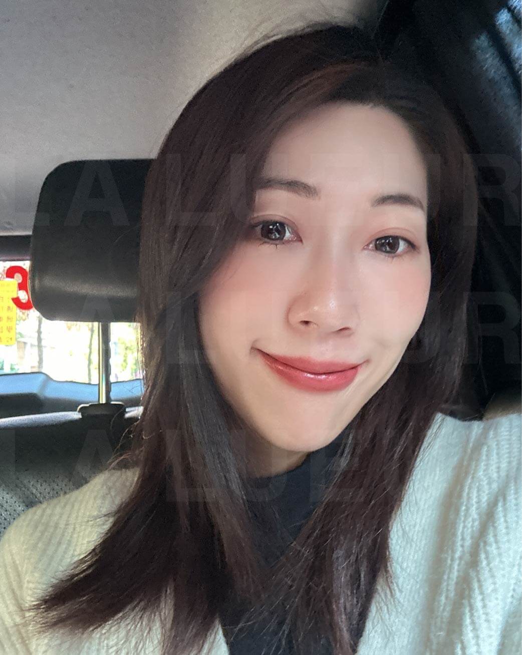 貴婦線性拉提-電波拉提-埋線拉提