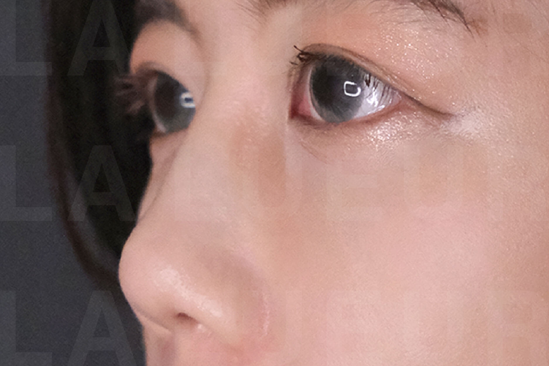 Before Image