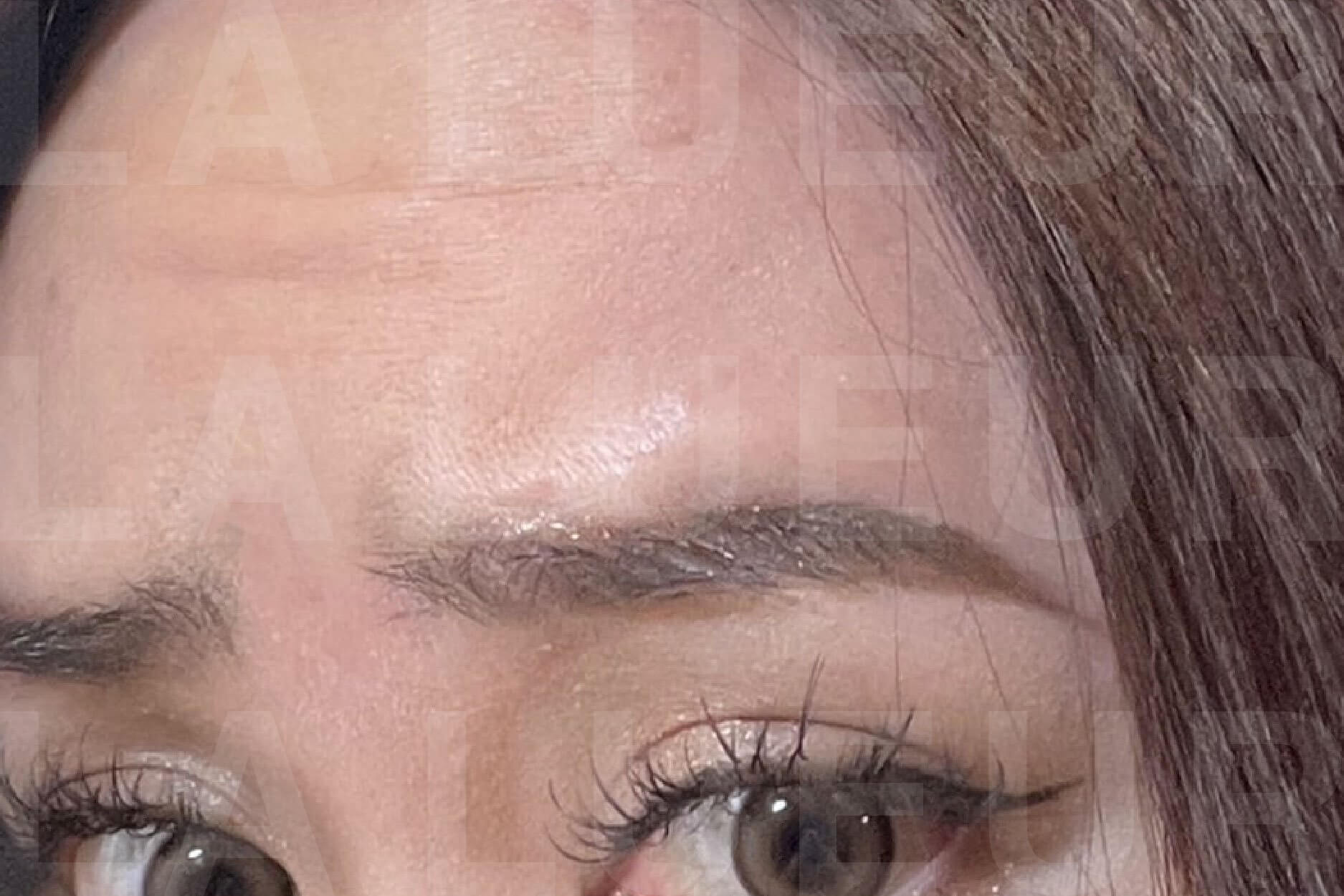 Before Image
