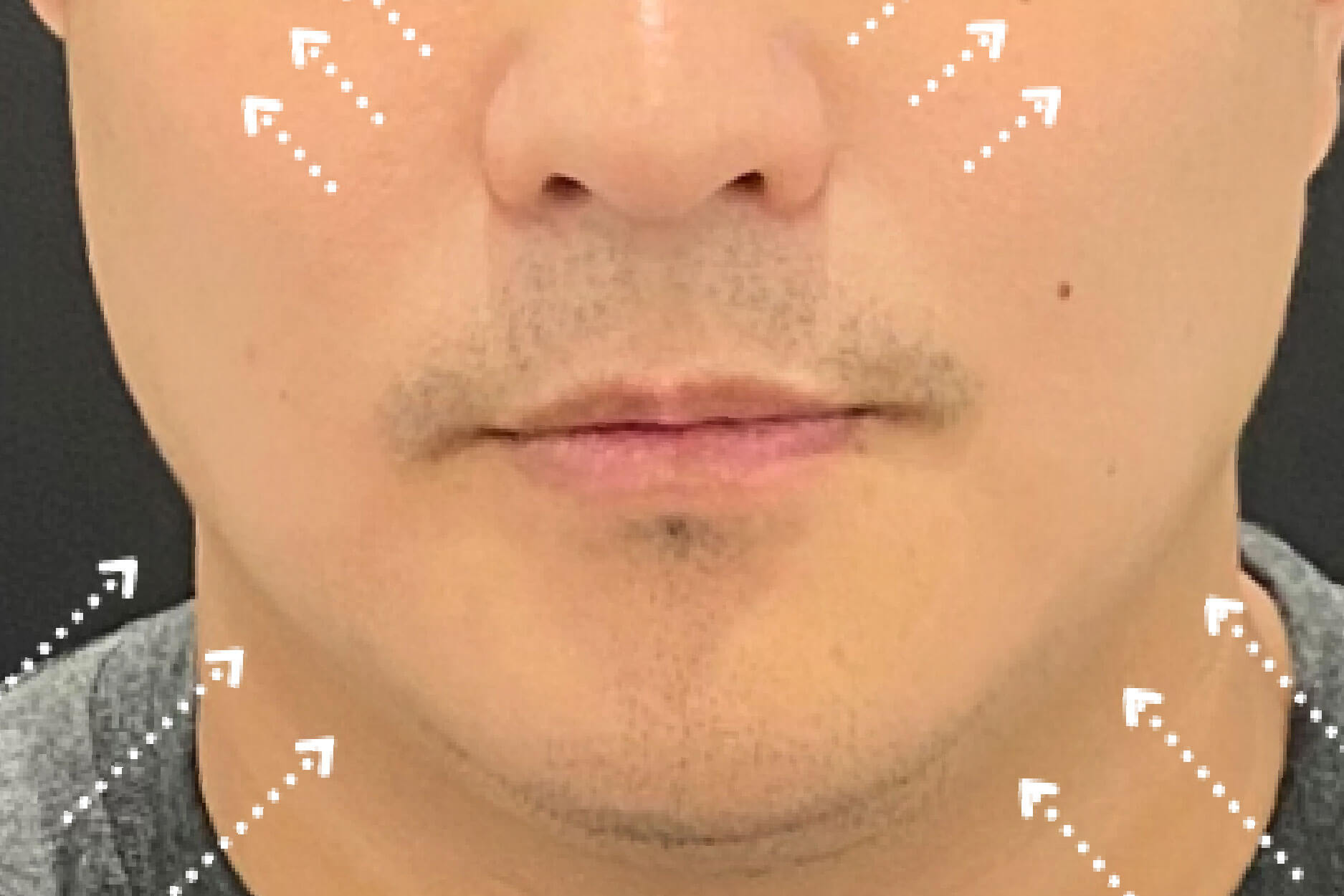 After Image