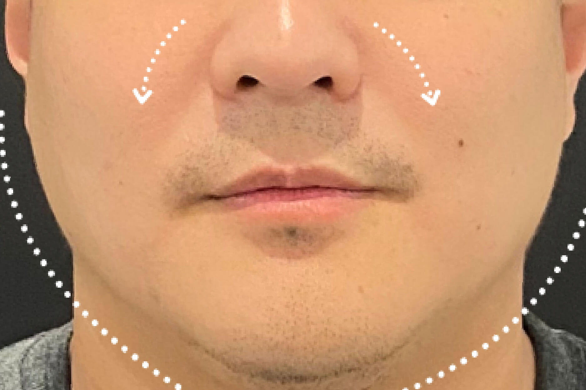 Before Image