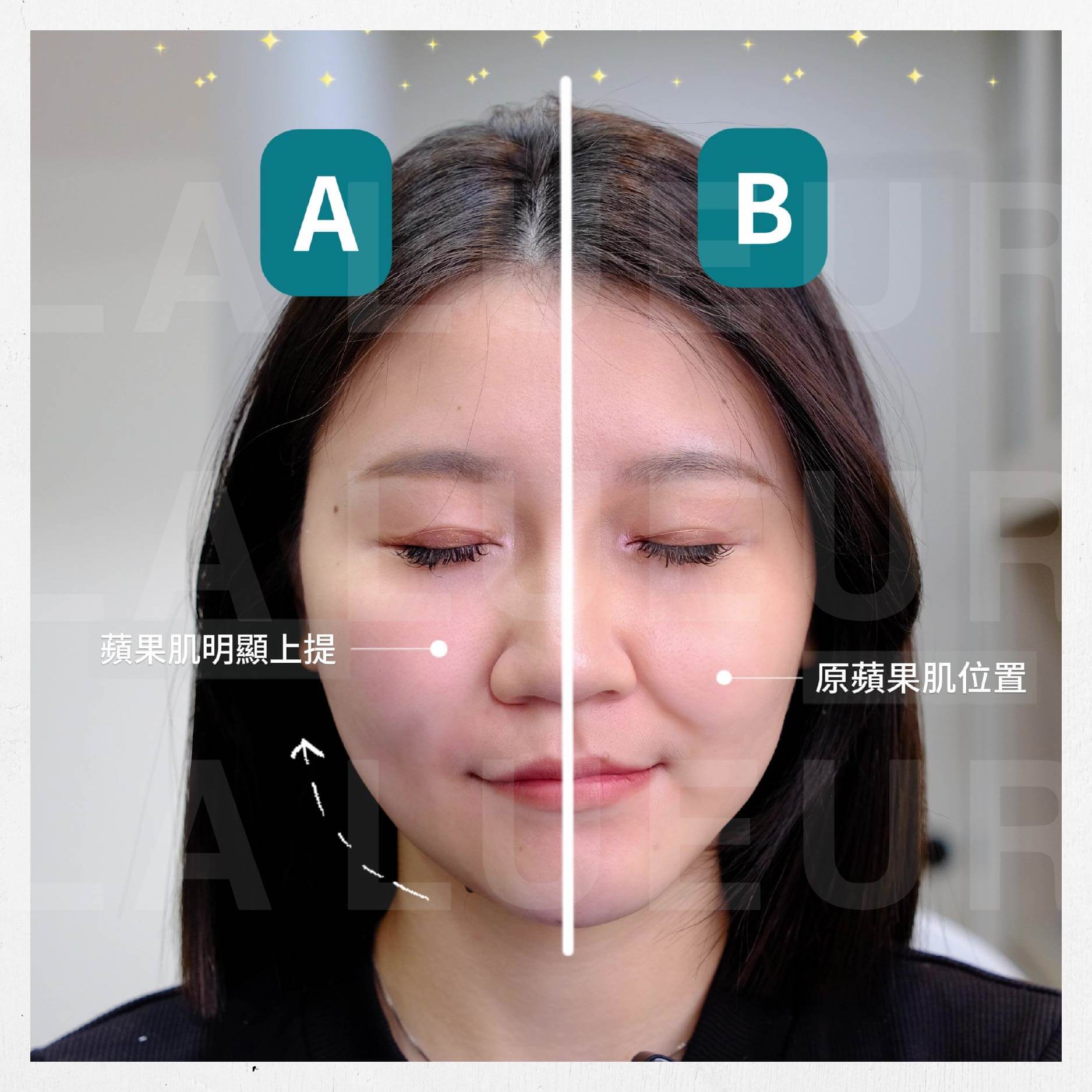 6D輪廓固定法