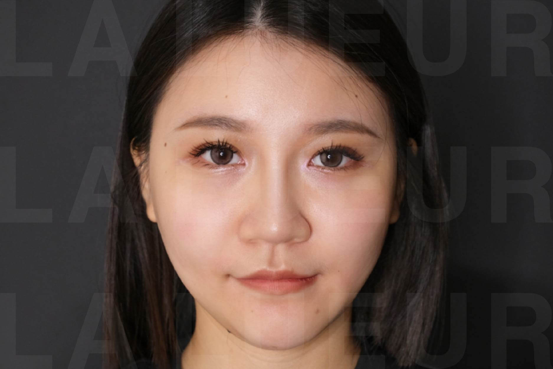 After Image