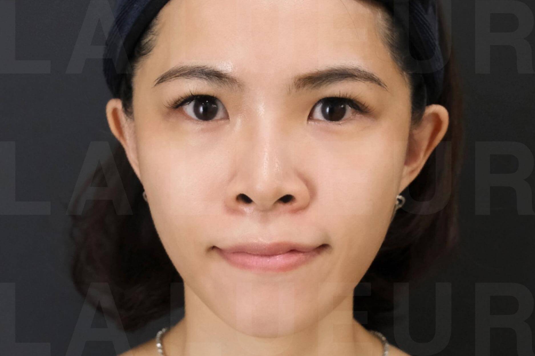 After Image