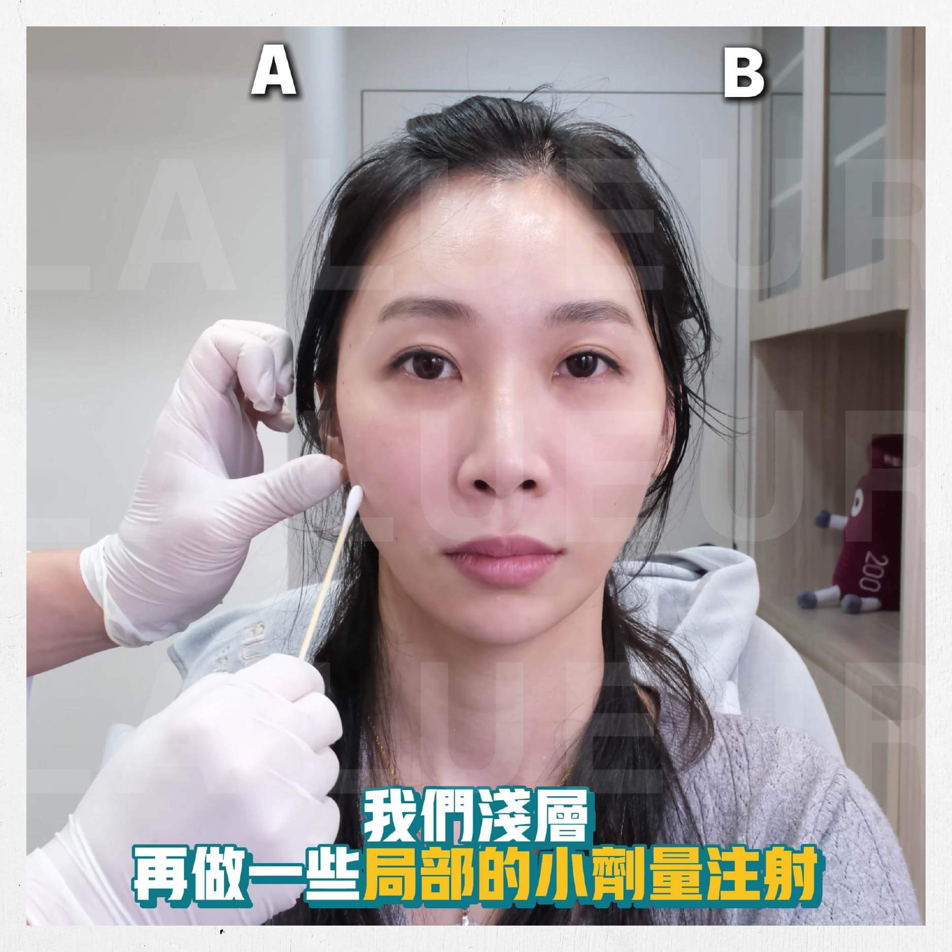 6D輪廓固定法