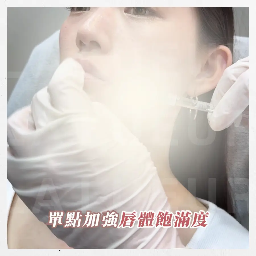 見證案例-三點式嘟嘟唇