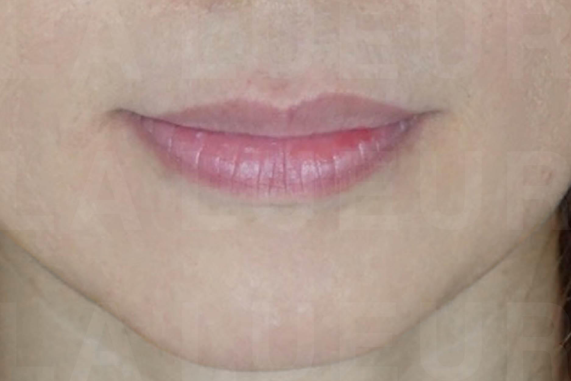 Before Image