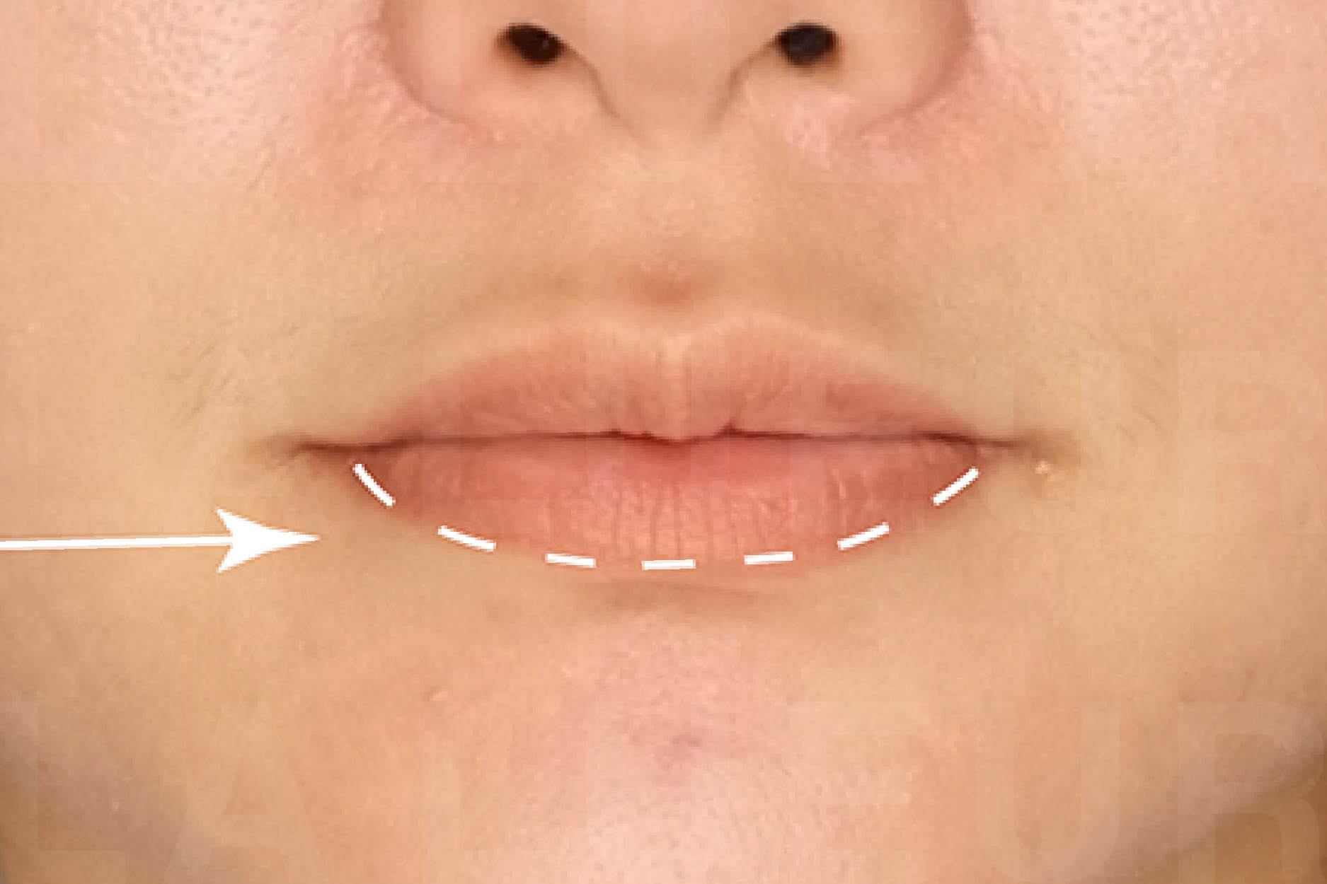 Before Image