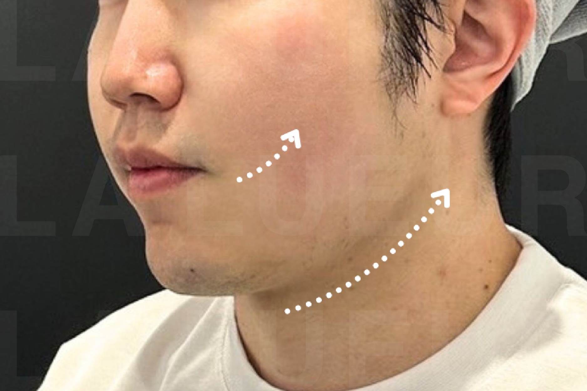 After Image