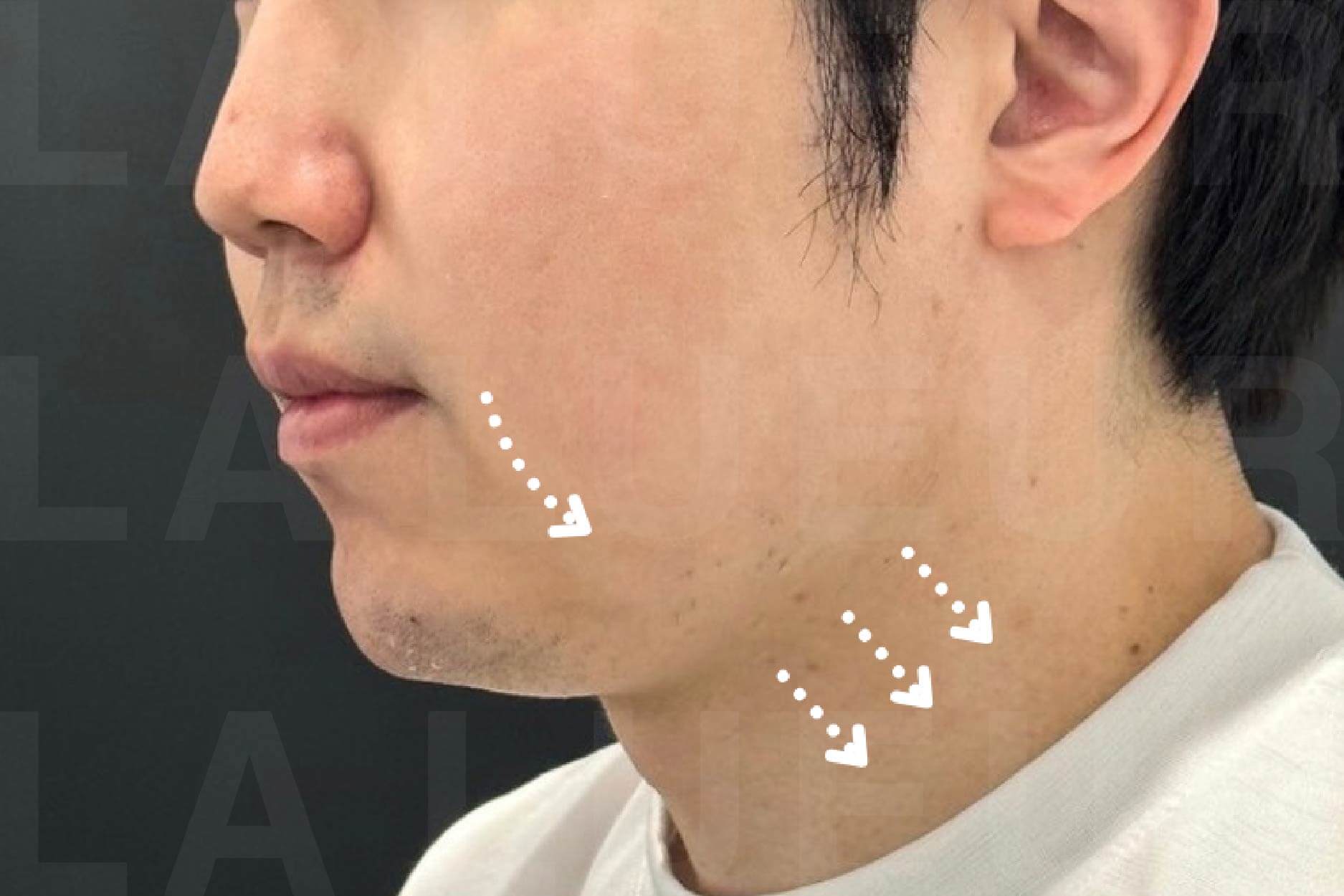 Before Image