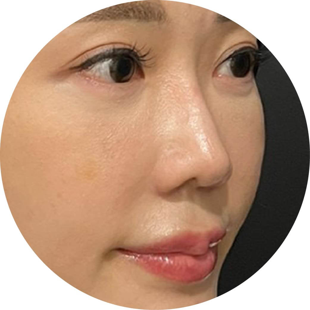 三點式嘟嘟唇+膠原蛋白熊貓針