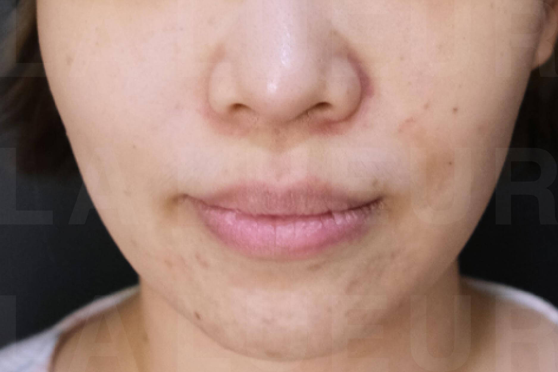 Before Image