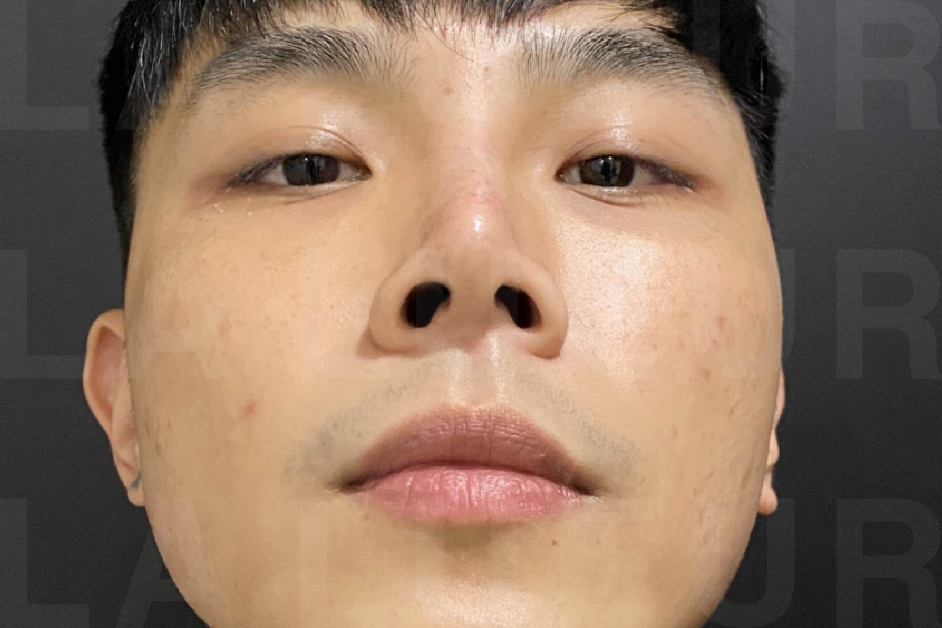 After Image