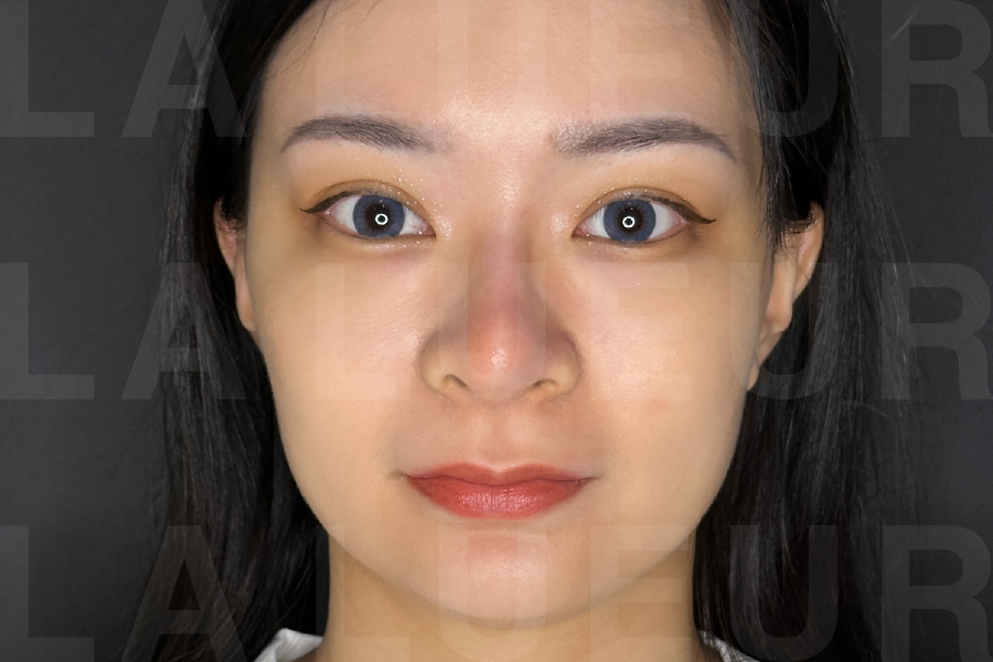 After Image