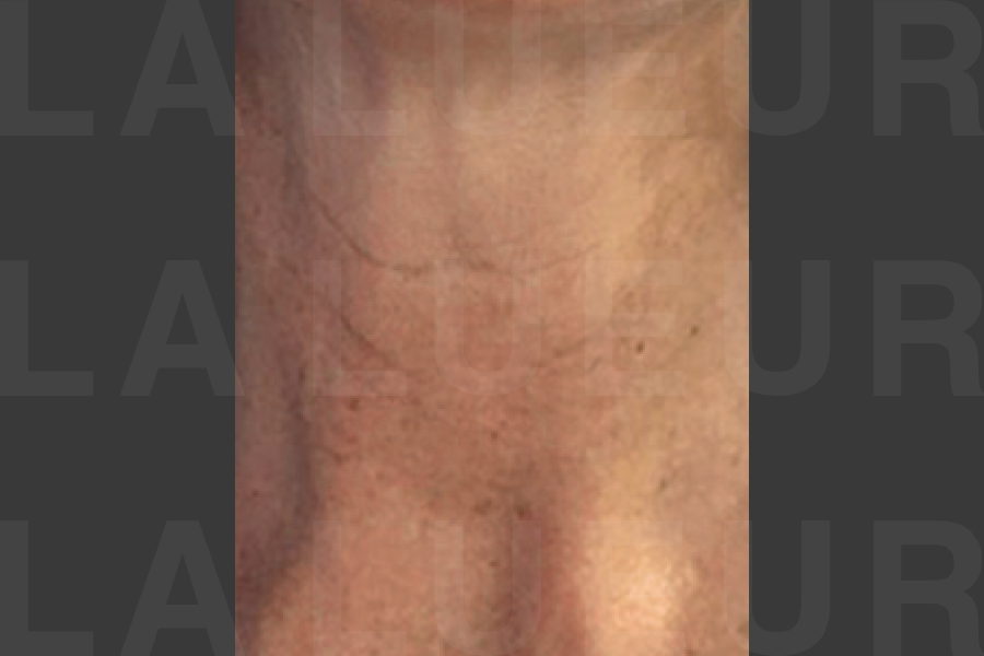 After Image