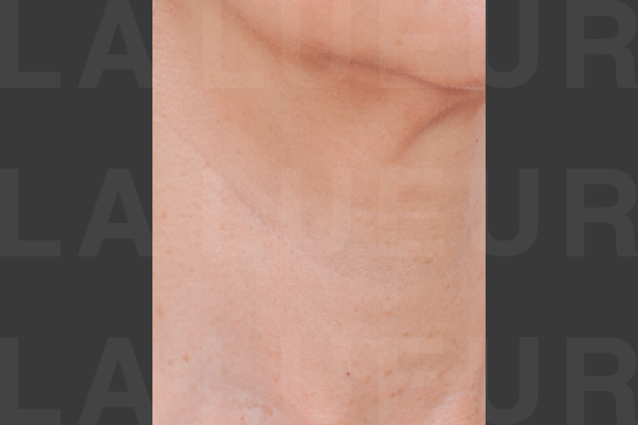 After Image