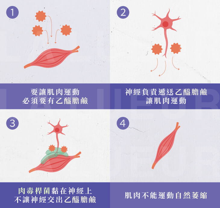 醫師專欄-肉毒小臉這樣打才有效