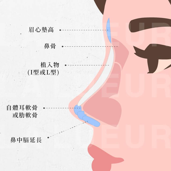 醫師專欄-鼻雕怎麼改善山根低(劉)