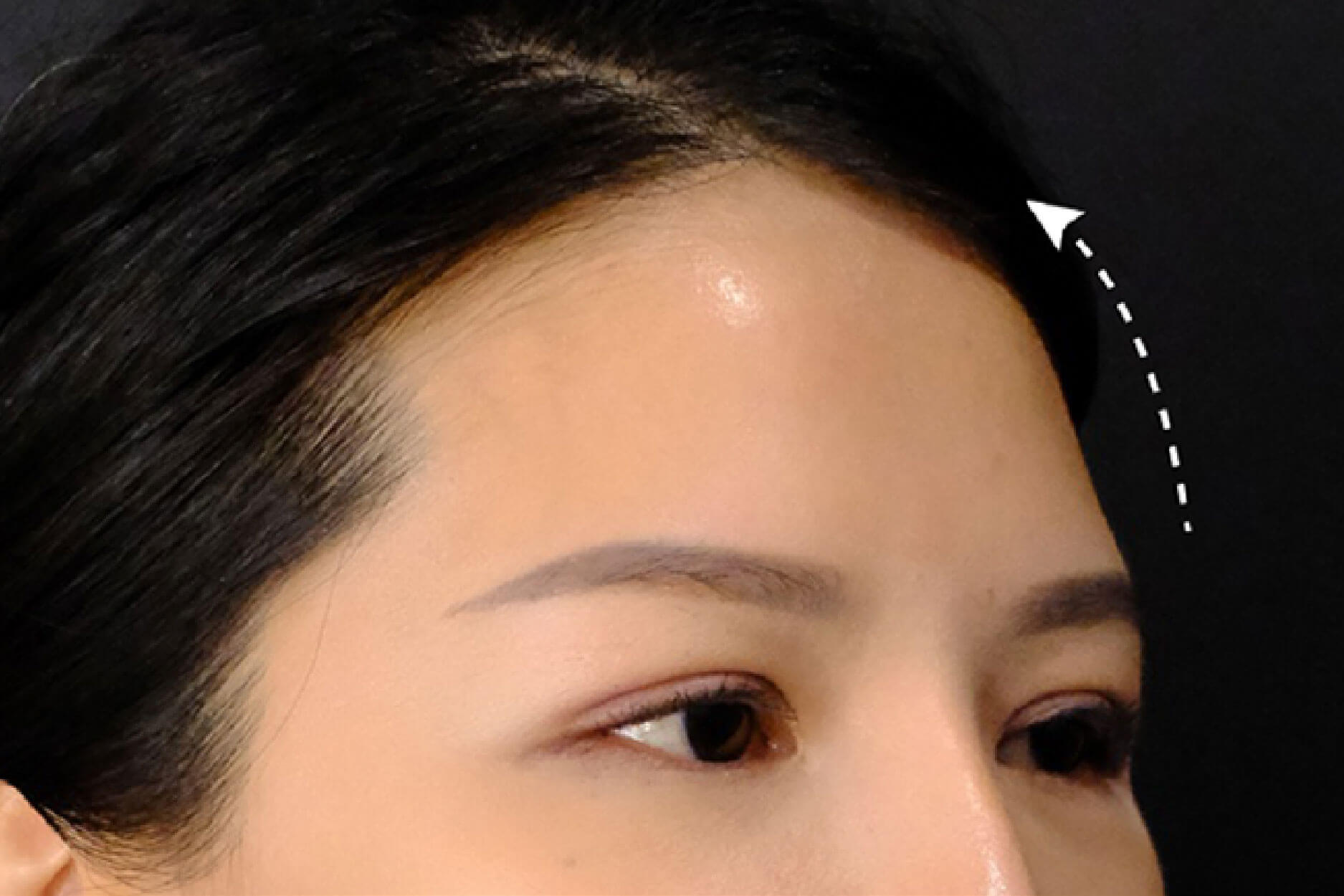 Before Image