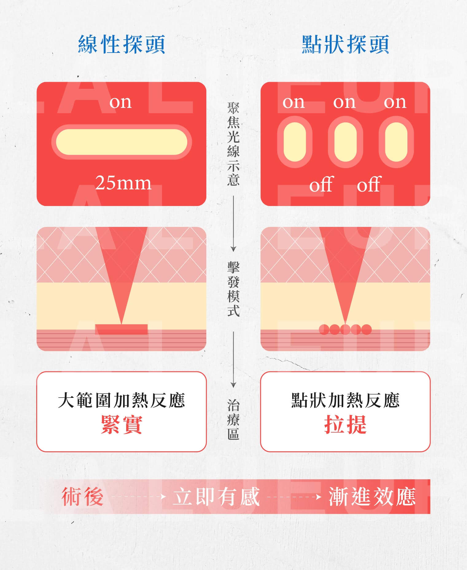 音波拉提