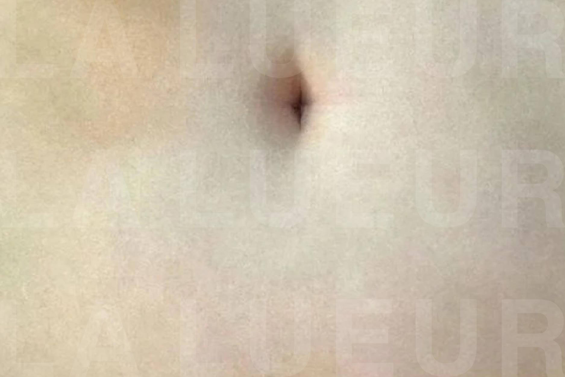 After Image