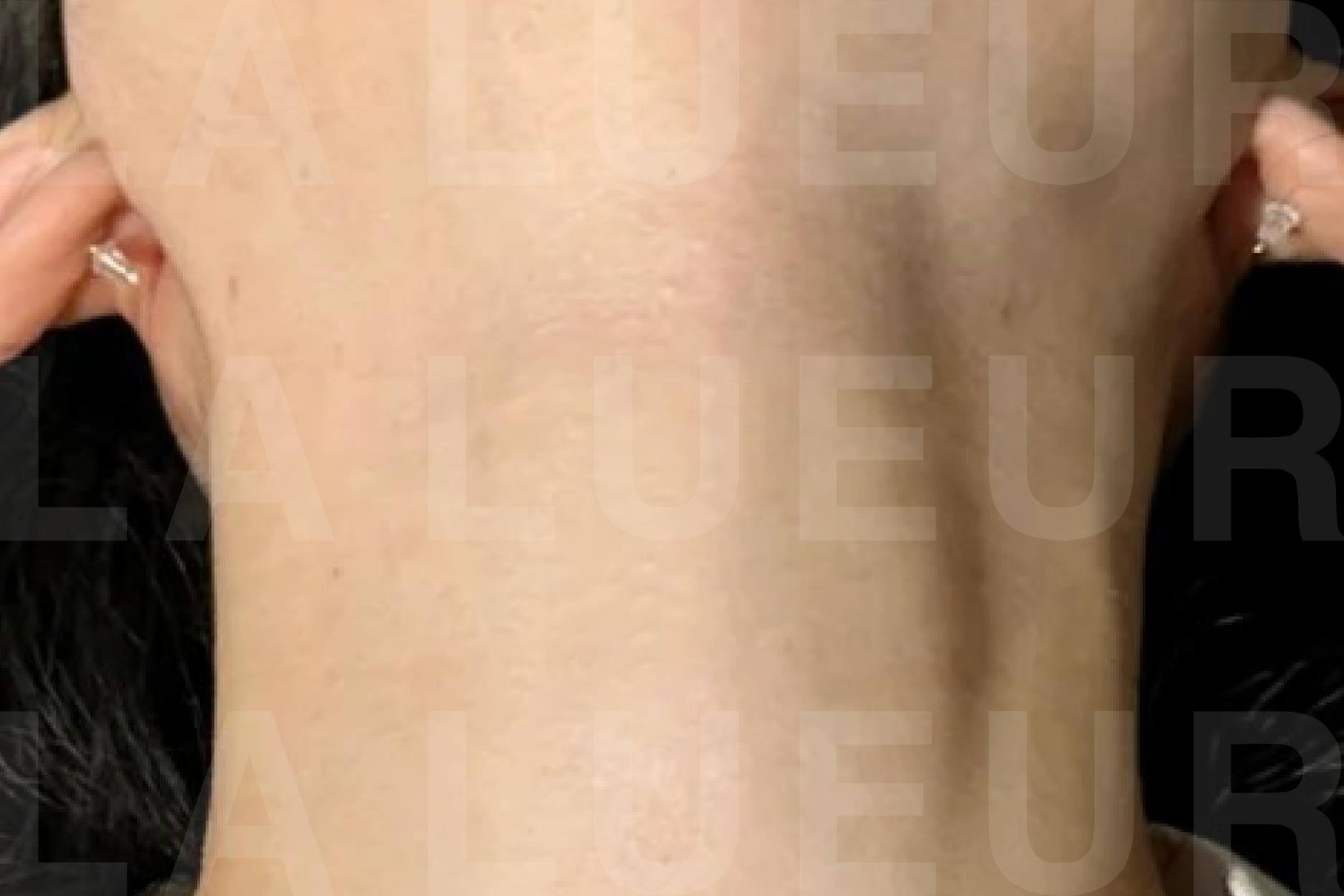 After Image
