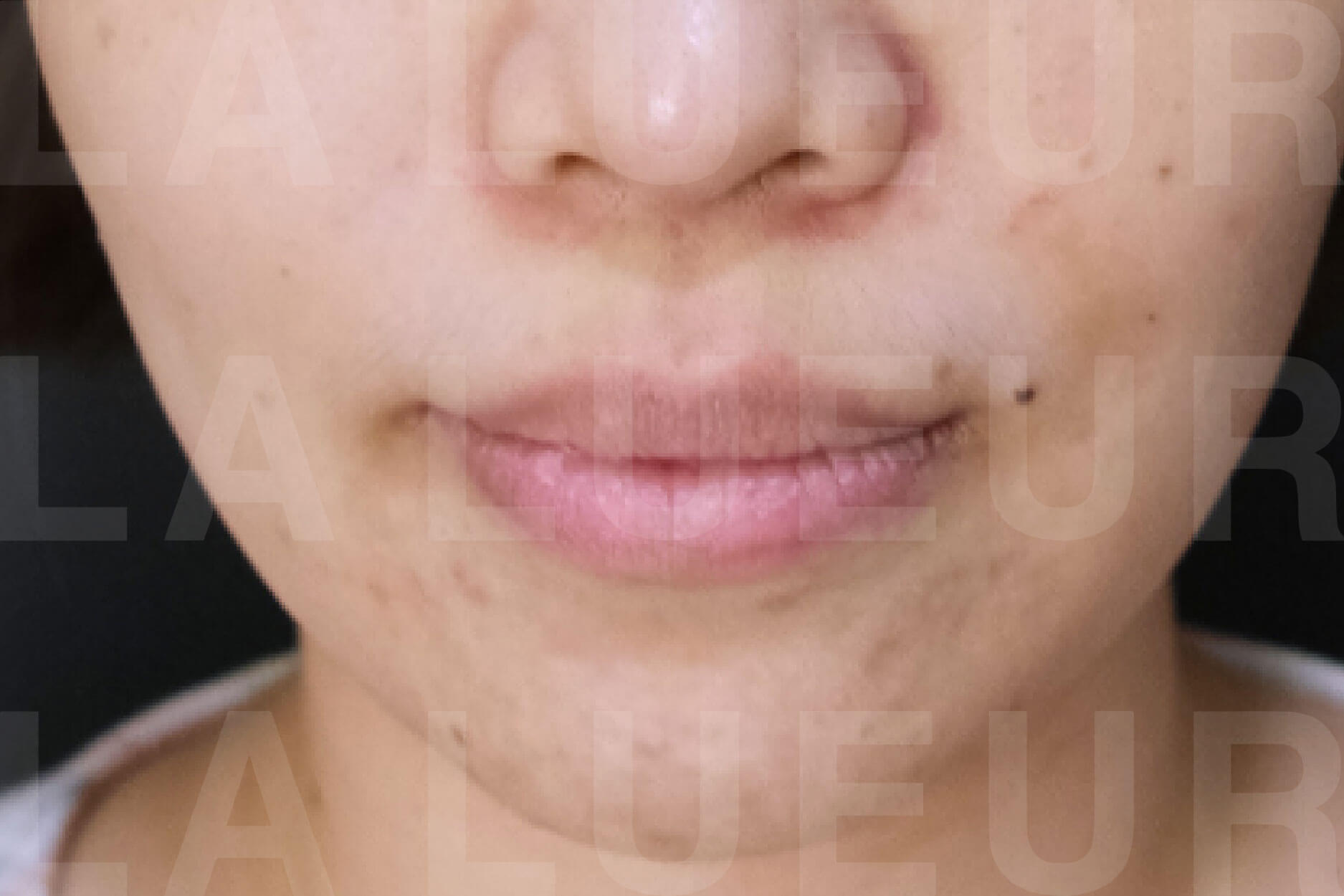 Before Image